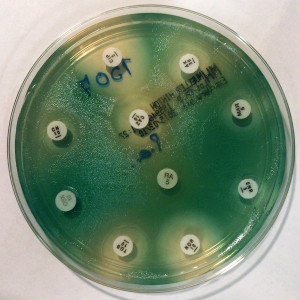 "Pseudomonas aeruginosa antibiogram" by Stefan Walkowski - Own work. Licensed under CC BY-SA 4.0 via Wikimedia Commons - https://commons.wikimedia.org/wiki/File:Pseudomonas_aeruginosa_antibiogram.jpg#/media/File:Pseudomonas_aeruginosa_antibiogram.jpg